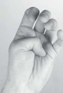 Symptômes de spasticité de la main – pouce dans la main