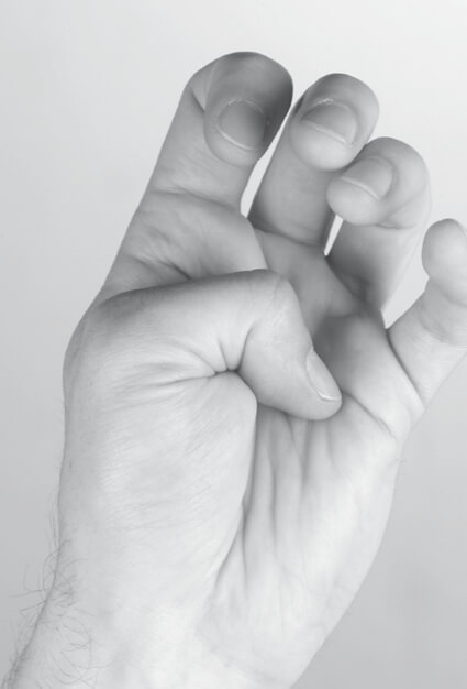 Spastik Syptome der Hand – Daumen in Hand Stellung